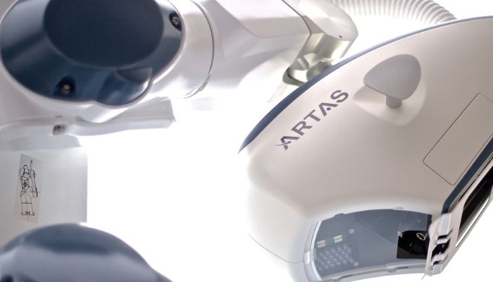 Precision and Perfection: ARTAS Robotic Hair Transplant