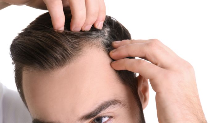 Precision and Perfection: ARTAS Robotic Hair Transplant