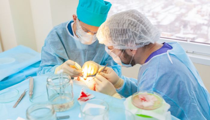 Corrective Surgery: The Ultimate Solution for Hair Plugs