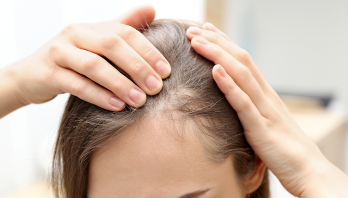 early signs of hair loss
