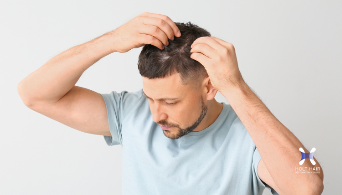 Is Your Hair Trying to Tell You Something? Recognizing the Early Signs of Hair Loss