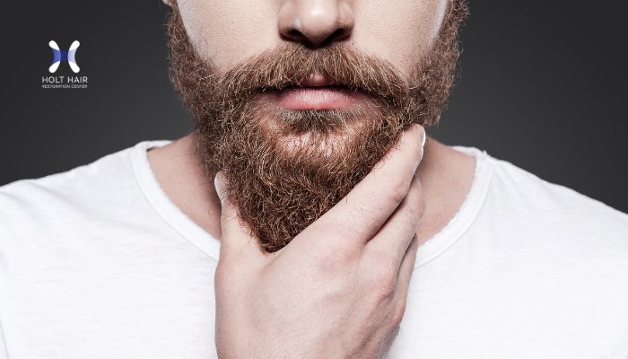 beard transplant