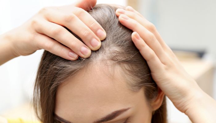 How to Stop Hair Thinning Before It Gets Worse